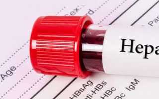 Что значит обнаружены антитела к гепатиту В в крови?
