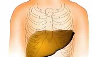 Гепатомегалия печени