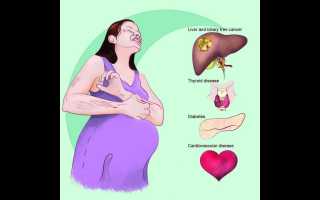 Гепатоз беременных, чем опасно заболевание