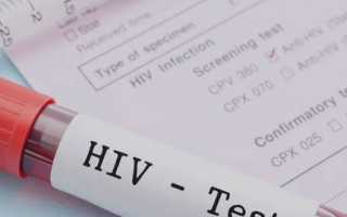 Как сдавать анализ на ВИЧ?