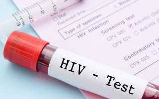 Нужно ли повторно проверять на ВИЧ?