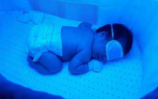 Фототерапия от желтушки у новорожденных
