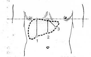 Методы перкуссии и пальпации печени