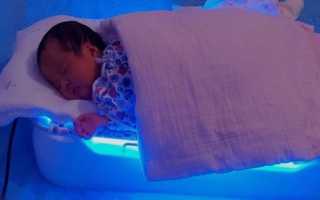 Как выбрать и правильно использовать лампу от желтушки для новорожденного