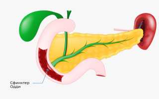 Дисфункция сфинктера Одди