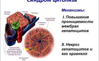 Синдром цитолиза печени